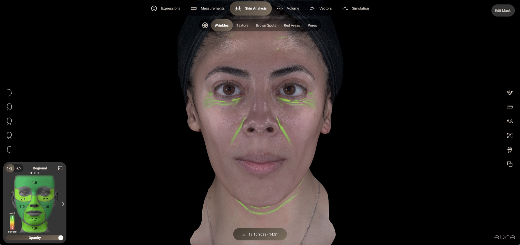 Aura wrinkle analysis: lines traced and graded zone by zone on the face